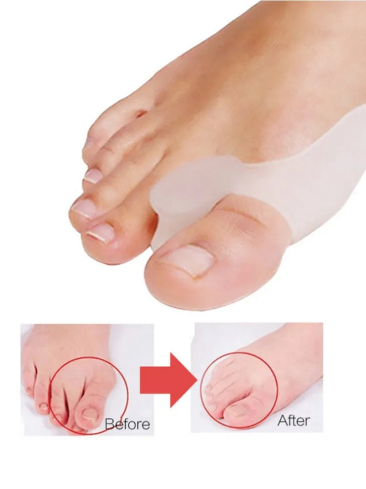 2PCS Silicone Gel Thumb Corrector Bunion Foot Toe Hallux Valgus Protector Separator Finger Straightener Adjuster Foot Care Tool